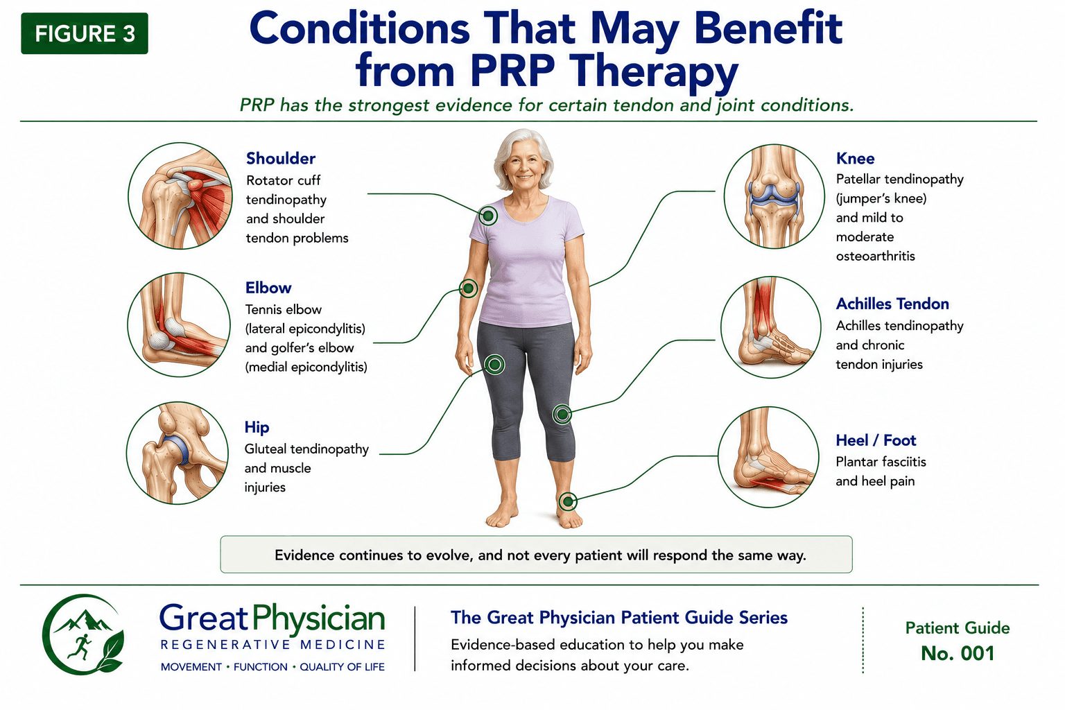Figure 3: Conditions that may benefit from PRP, including tennis elbow, patellar and Achilles tendinopathy, plantar fasciitis, rotator cuff disorders, and mild to moderate knee osteoarthritis.